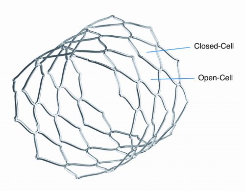 Open-Cell_Closed-Cell_AndraStent